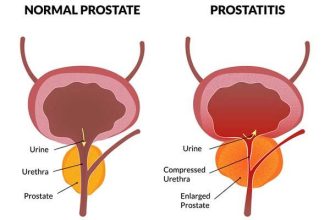 Exposing How Website Uses Unverifiable Experts And Unsupported Claims To Market Unregistered Prostatitis Product