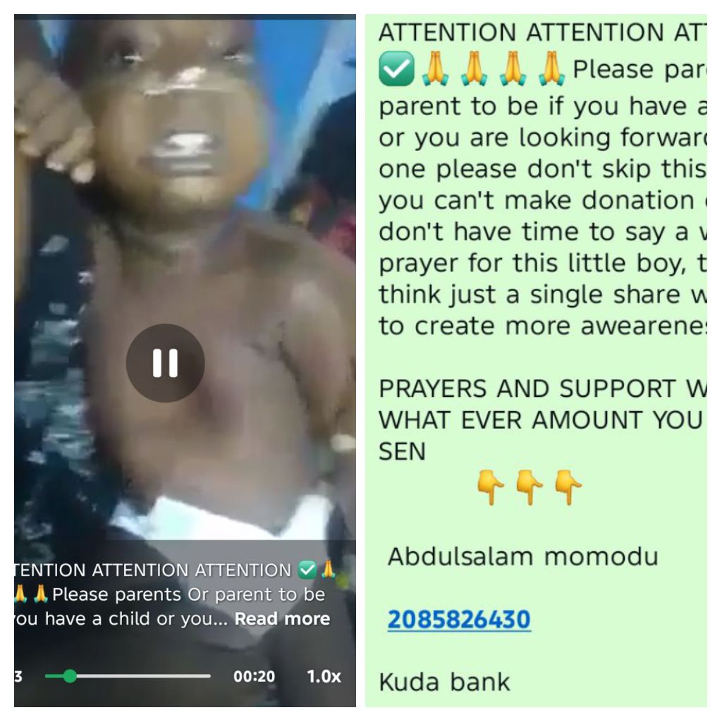 Exposing Scammers Using Health Challenges Of Children For Fraud